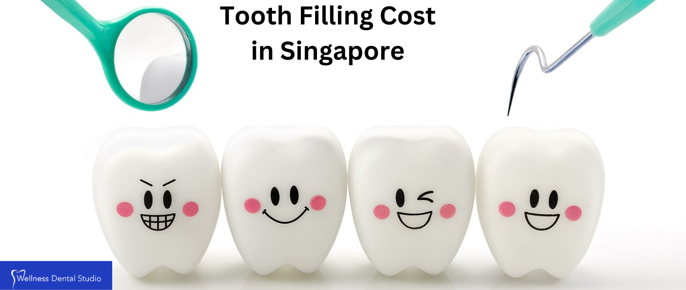 Tooth filling cost in singapore