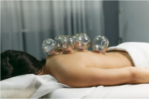 What are the Advantages of Cupping therapy?